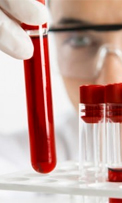 Bioquímica Sanguinea